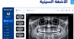 عرض الأشعة