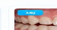 بعد