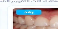 بعد