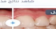 قبل