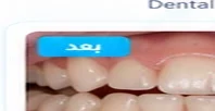 بعد