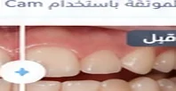 قبل