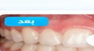 بعد