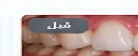 بعد العلاج