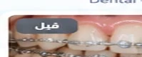 بعد العلاج