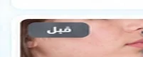 بعد العلاج