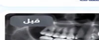 بعد العلاج