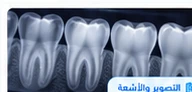 صورة مقال عن مقارنة بين أنواع التصوير للأسنان الرقمي