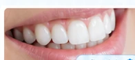 صورة مقال عن دراسة حالة: كيف ساهم Dental Cam في تحسين خطة العلاج