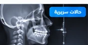 صورة مقال عن قبل وبعد: حالات حقيقية لتقويم الأسنان مع الصور