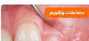 صورة مقال عن أشهر مشاكل تقويم الأسنان وطرق التعامل معها