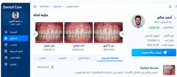 مثال توضيحي لواجهة متابعة الحالة داخل Dental Cam