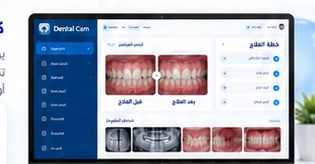 برنامج Dental Cam لإعداد التقارير