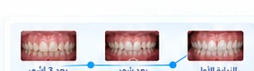 الصور الدورية خلال العلاج