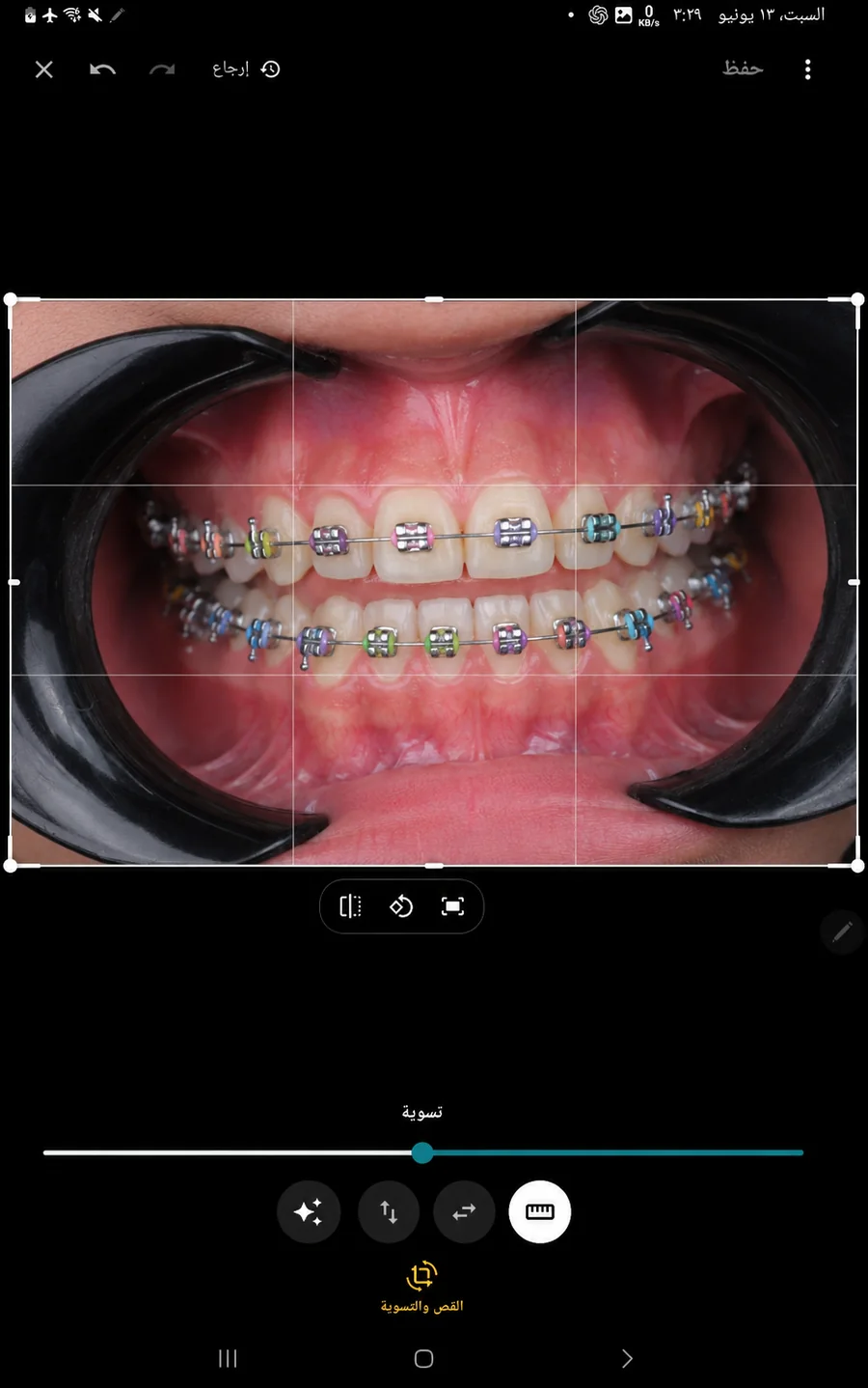 Dental Cam app screen 16
