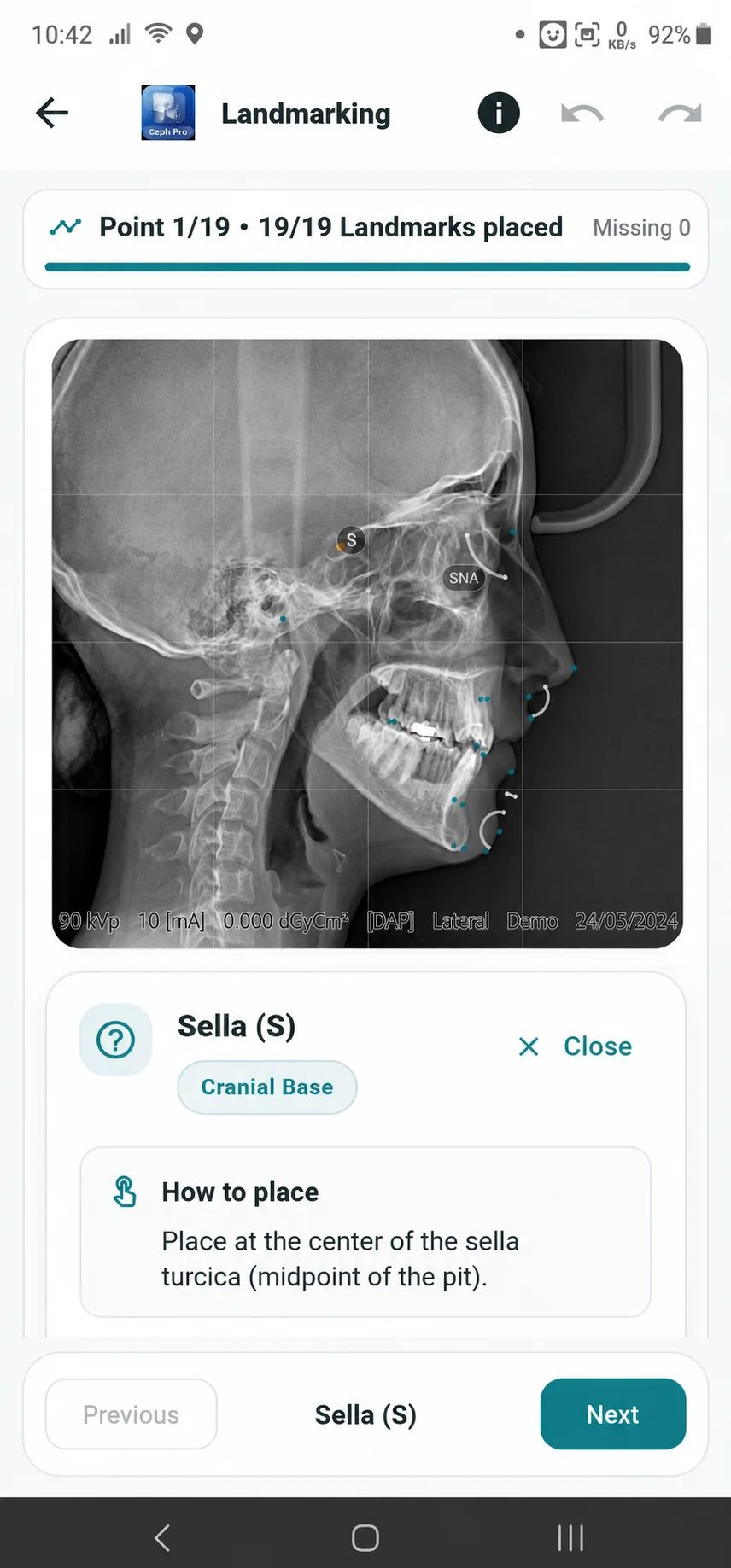 Dental Cam app screen 22