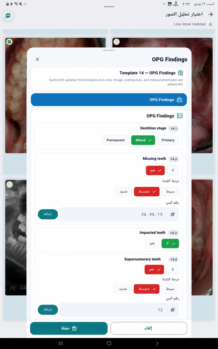 Dental Cam app screen 23